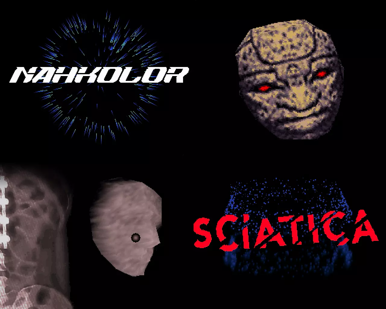 Sciatica (2023) by Nah-Kolor